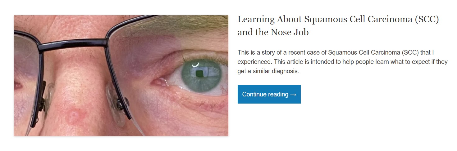 squamous cell carcinoma nose